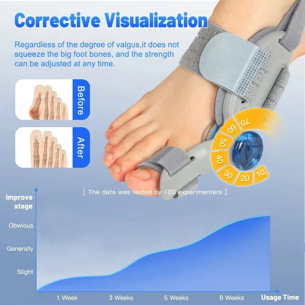 Adjustable Rotating Bunion Corrector - Frezy Haven 