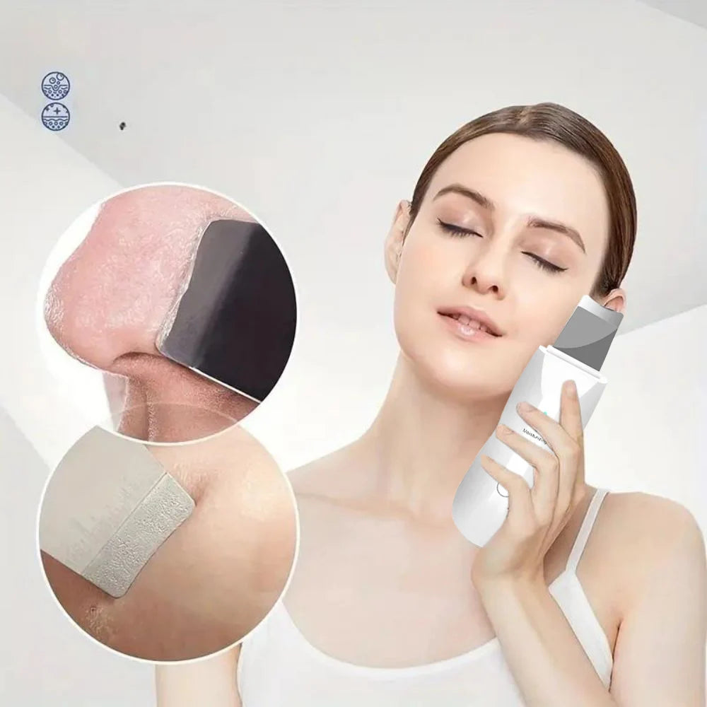 Ultrasonic Skin Scrubber Pore Cleaner - Frezy Haven 