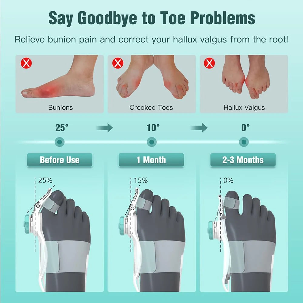 Adjustable Rotating Bunion Corrector - Frezy Haven 