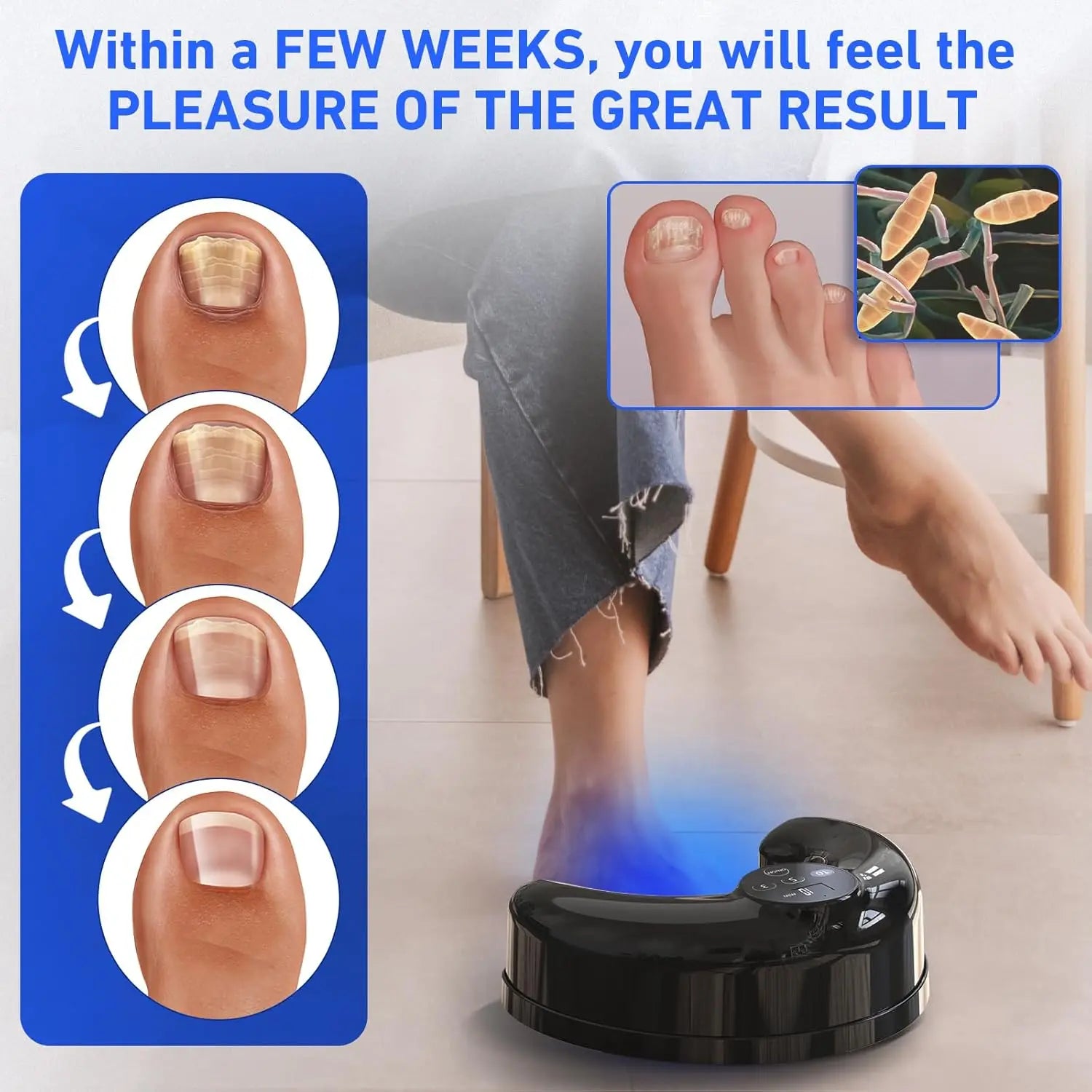 Wireless Nail Fungus Laser - Frezy Haven 