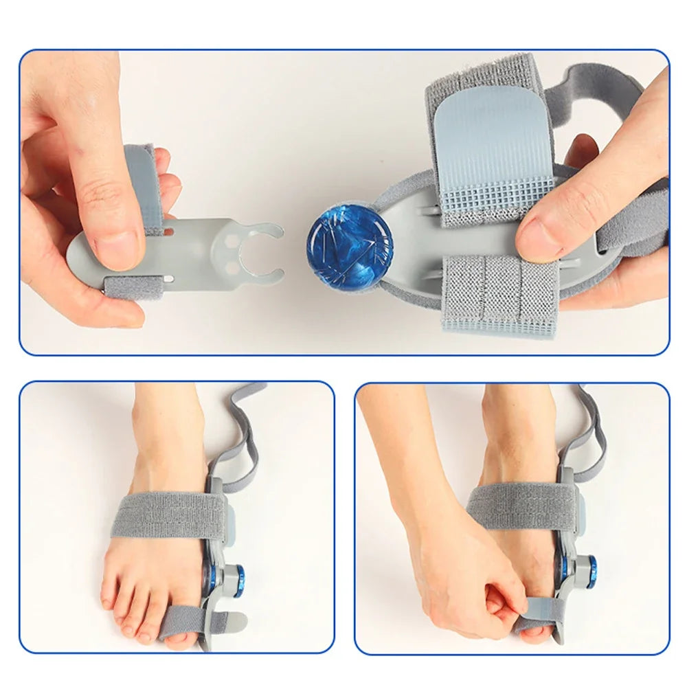 Adjustable Rotating Bunion Corrector - Frezy Haven 