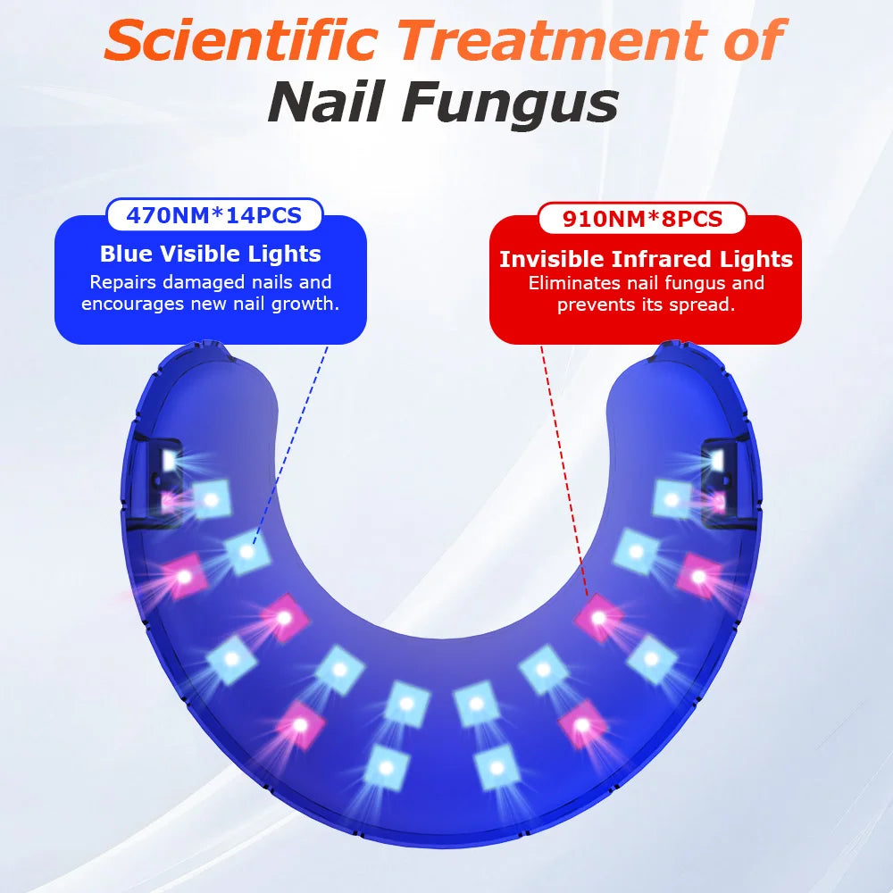 Wireless Nail Fungus Laser - Frezy Haven 
