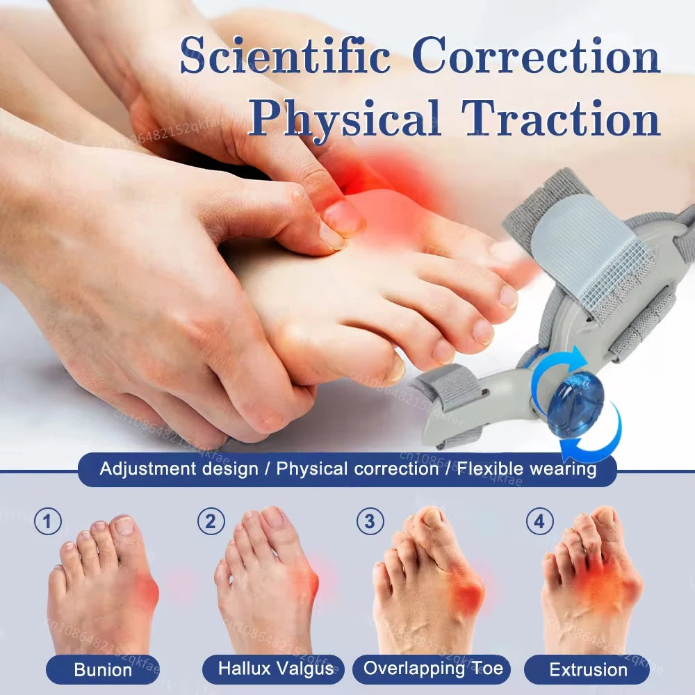 Adjustable Rotating Bunion Corrector - Frezy Haven 