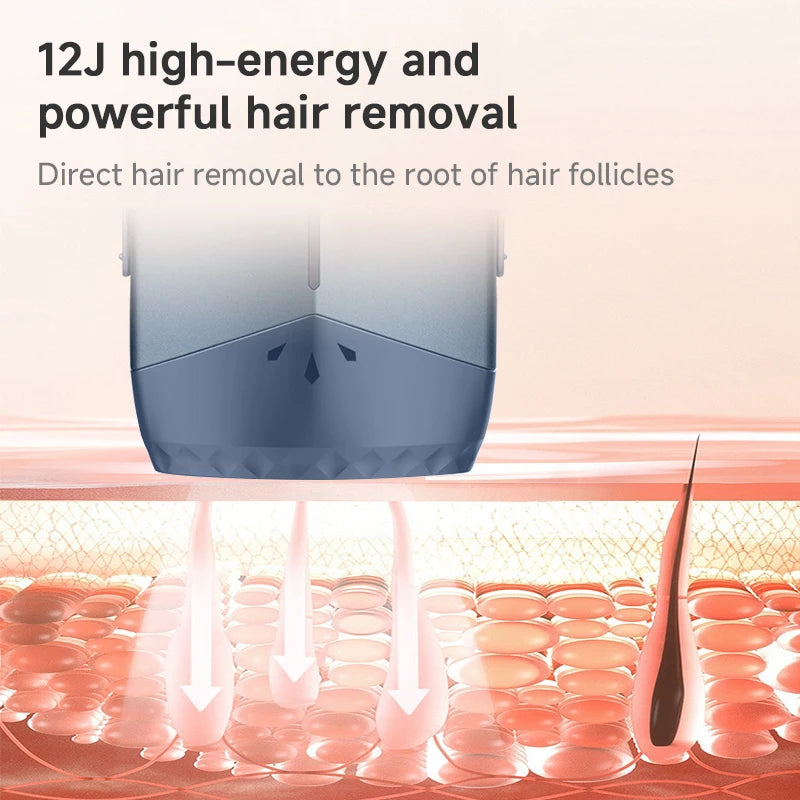 Body Laser Hair Removal - Frezy Haven 